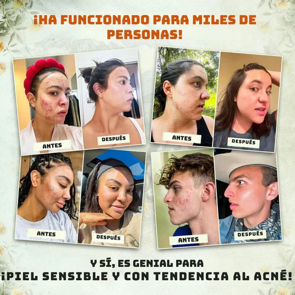 2 por 1 | Bálsamo con Sebo de Res y Miel de Manuka