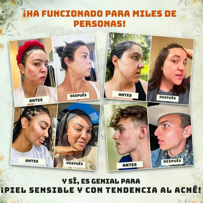 2 por 1 | Bálsamo con Sebo de Res y Miel de Manuka