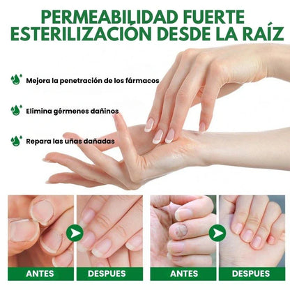 7 Days Fungus Free Nails® - Protege y elimina el hongo de tus Uñas