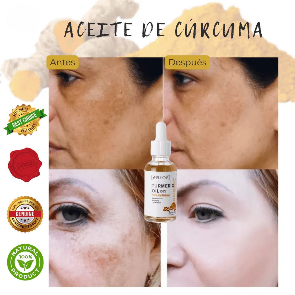 1+1 GRATIS | Aceite Esencial de Cúrcuma™ (EELHOE)
