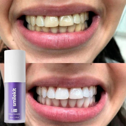2X V34 Smile | Blanqueador Dental Rápido