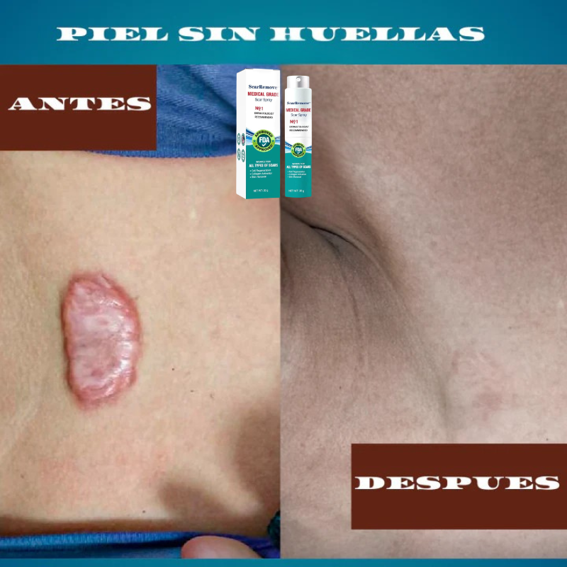 2x1 I Spray Cicatrizante