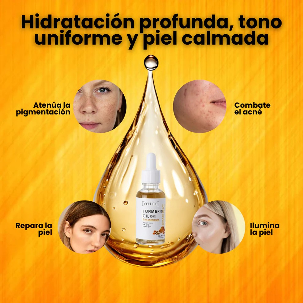 1+1 GRATIS | Aceite Esencial de Cúrcuma™ (EELHOE)