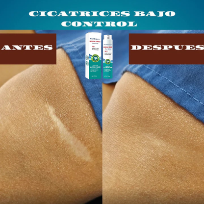 2x1 I Spray Cicatrizante