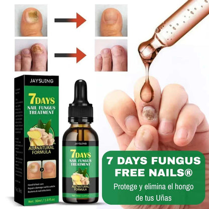 7 Days Fungus Free Nails® - Protege y elimina el hongo de tus Uñas