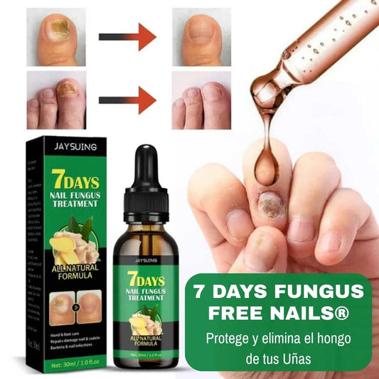7 Days Fungus Free Nails® - Protege y elimina el hongo de tus Uñas