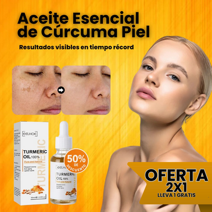 1+1 GRATIS | Aceite Esencial de Cúrcuma™ (EELHOE)