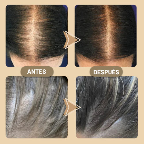 Aceite Capilar Vegano – Fortalece y Estimula el Crecimiento