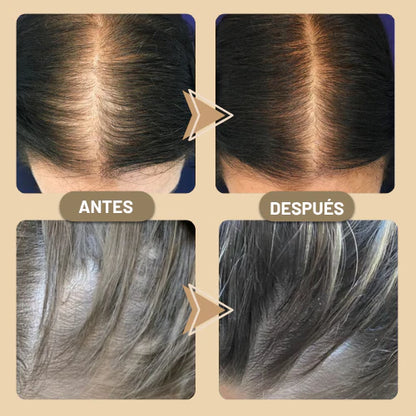 Aceite Capilar Vegano – Fortalece y Estimula el Crecimiento