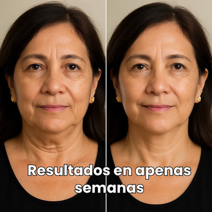 Tonificador de Rostro SkinLift | Elimina papada y flacidez
