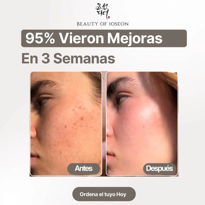 Bloqueador Beauty of Joseon